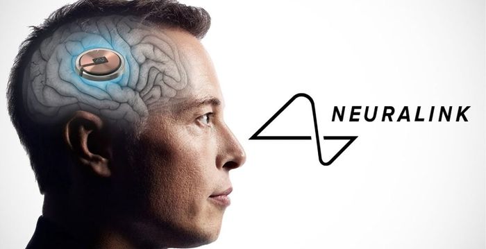 Neuralink